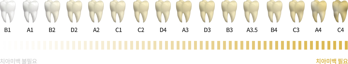 치아색상 자가진단법 이미지